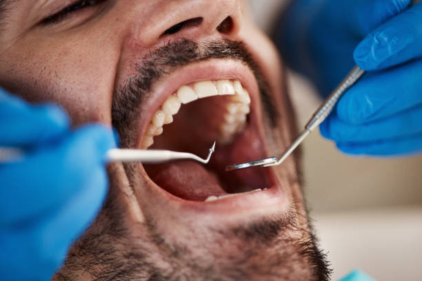 Best After-Hours Emergency Dentist in Murphys, CA