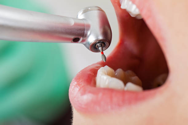 Best Same-Day Emergency Dentist in Murphys, CA
